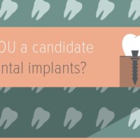 Dental implants are an ideal solution for missing teeth.