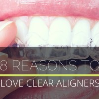 8 reasons to love clear aligners