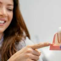 Woman smiling and pointing at dental implant model.