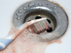 bloody toothbrush lies in a washbasin. dental concept